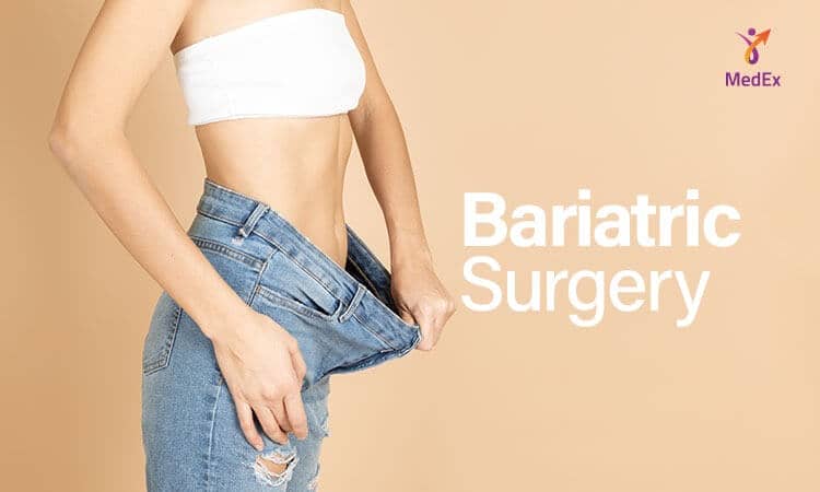 Baratric surgery
