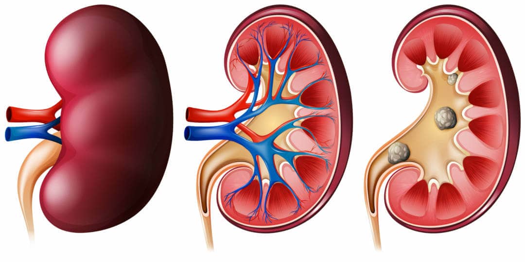 kidney scaled