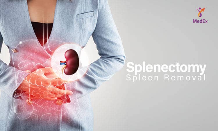 Splenectomy Spleen Removal
